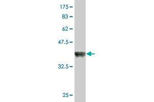 Western Blotting (WB) image for anti-Deltex E3 ubiquitin ligase 3L (DTX3L) (AA 3-110) antibody (ABIN531034)