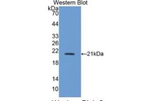 Western Blotting (WB) image for Nitric Oxide Synthase 2, Inducible (NOS2) ELISA Kit (ABIN6574224)
