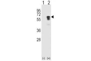 Western blot analysis of ALK2 antibody and 293 cell lysate (2 ug/lane) either nontransfected (Lane 1) or transiently transfected (2) with the ACVR1 gene. (ACVR1 抗体  (AA 132-162))
