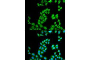 Immunofluorescence analysis of MCF-7 cells using RNASE13 antibody. (RNASE13 抗体)