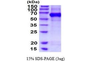 SDS-PAGE (SDS) image for Chromosome 3 Open Reading Frame 64 (C3orf64) (AA 20-527) protein (His tag) (ABIN5854550) (AER61 Protein (AA 20-527) (His tag))
