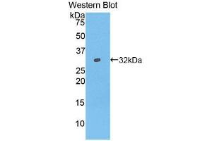 Western blot analysis of the recombinant protein. (IFNAR1 抗体  (AA 244-512))