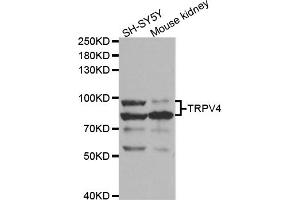 Western blot analysis of extracts of various cell lines, using TRPV4 antibody (ABIN5973304) at 1/1000 dilution. (TRPV4 抗体)