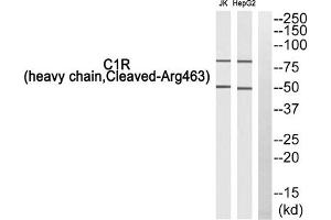 Western blot analysis of extracts from Jurkat cells and HepG2 cells, using C1R (heavy chain, Cleaved-Arg463) antibody. (C1R 抗体  (Cleaved-Arg463, Heavy Chain))