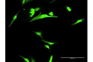 Immunofluorescence of purified MaxPab antibody to ANXA1 on HeLa cell. (Annexin a1 抗体  (AA 1-346))