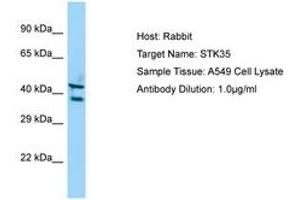Image no. 1 for anti-Serine/threonine Kinase 35 (STK35) (C-Term) antibody (ABIN6750140) (STK35 抗体  (C-Term))