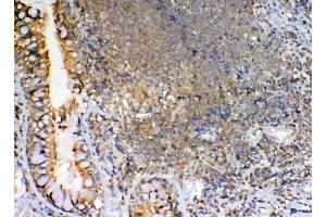IHC analysis of GRK2 using anti-GRK2 antibody (ABIN5693069). (GRK2 抗体)