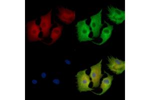 ABIN7095496 and ABIN7099553 staining  cells by IF/ICC.