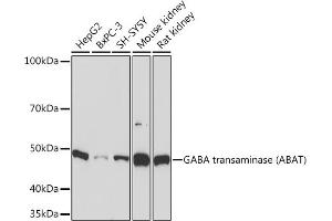 Western blot analysis of extracts of various cell lines, using GABA transaminase (GABA transaminase (ABAT)) Rabbit mAb (ABIN7265336) at 1:1000 dilution. (ABAT 抗体)