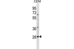 Western Blotting (WB) image for anti-AlkB, Alkylation Repair Homolog 4 (E. Coli) (ALKBH4) antibody (ABIN2996941) (ALKBH4 抗体)