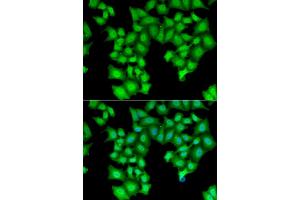 Immunofluorescence analysis of HeLa cell using CPSF3L antibody. (CPSF3L 抗体)