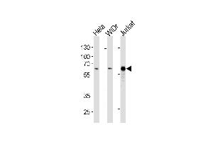 HDAC1 Antibody (ABIN1882195 and ABIN2843403) western blot analysis in Hela,WiDr,Jurkat cell line lysates (35 μg/lane). (HDAC1 抗体)