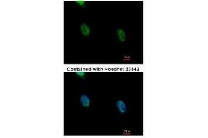 ICC/IF Image Immunofluorescence analysis of paraformaldehyde-fixed HeLa, using hnRNP K, antibody at 1:500 dilution. (HNRNPK 抗体)
