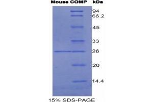 SDS-PAGE of Protein Standard from the Kit (Highly purified E. (COMP ELISA 试剂盒)