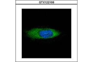 Image no. 2 for anti-Heat Shock Protein 70kDa Family, Member 13 (HSPA13) (AA 204-423) antibody (ABIN1498740)