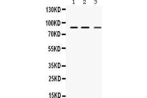Western Blotting (WB) image for anti-Mediterranean Fever (MEFV) (AA 5-39), (N-Term) antibody (ABIN3042357) (MEFV 抗体  (N-Term))