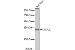 Western blot analysis of extracts of Rat heart using MYOCD Polyclonal Antibody at dilution of 1:1000. (Myocardin 抗体)