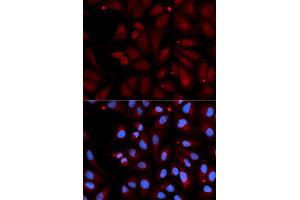 Immunofluorescence analysis of U2OS cell using MAOB antibody. (Monoamine Oxidase B 抗体)