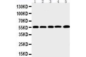 Anti-MMP12 antibody, Western blotting Lane 1: SMMC Cell Lysate Lane 2: HEPA Cell Lysate Lane 3: HELA Cell Lysate Lane 4: K562 Cell Lysate Lane 5: MCF-7 Cell Lysate (MMP12 抗体  (C-Term))