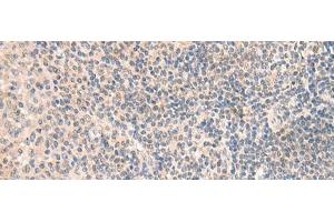 Immunohistochemistry of paraffin-embedded Human tonsil tissue using GRM2 Polyclonal Antibody at dilution of 1:50(x200) (GRM2 抗体)