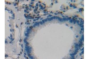 Immunohistochemistry (IHC) image for anti-Tumor Protein P53 (TP53) (AA 134-387) antibody (ABIN7429403)