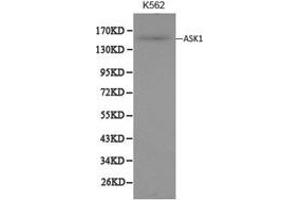 Western Blotting (WB) image for anti-Mitogen-Activated Protein Kinase Kinase Kinase 5 (MAP3K5) antibody (ABIN1873617) (ASK1 抗体)