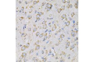 Immunohistochemistry of paraffin-embedded rat brain using IL10RA Antibody (ABIN3022614, ABIN3022615, ABIN3022616, ABIN1513078 and ABIN6218954) at dilution of 1:100 (40x lens). (IL-10RA 抗体  (AA 22-230))