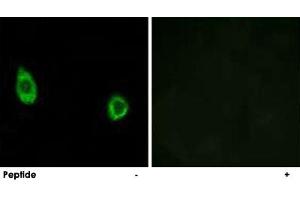 Immunofluorescence analysis of HUVEC cells, using CHST9 polyclonal antibody .