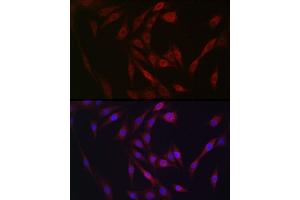 Immunofluorescence analysis of NIH/3T3 cells using FGF23 antibody (ABIN6127894, ABIN6140600, ABIN6140602 and ABIN6221721) at dilution of 1:25. (FGF23 抗体  (AA 25-251))