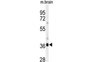 Western Blotting (WB) image for anti-Sirtuin 3 (SIRT3) antibody (ABIN2911469)
