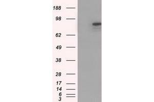 HEK293T cells were transfected with the pCMV6-ENTRY control (Left lane) or pCMV6-ENTRY CDH13 (Right lane) cDNA for 48 hrs and lysed. (Cadherin 13 抗体)