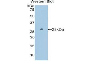 Western blot analysis of the recombinant protein. (HLA-E 抗体  (AA 136-350))