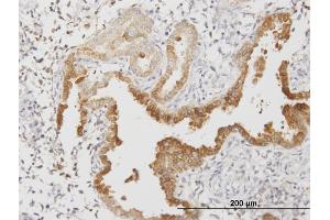 Immunoperoxidase of monoclonal antibody to ANXA4 on formalin-fixed paraffin-embedded human endometrium. (Annexin IV 抗体  (AA 1-321))