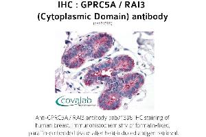 Image no. 1 for anti-G Protein-Coupled Receptor, Family C, Group 5, Member A (GPRC5A) (1st Cytoplasmic Domain) antibody (ABIN1735206) (GPRC5A 抗体  (1st Cytoplasmic Domain))