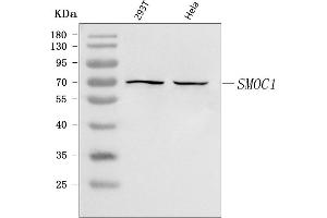 Western blot analysis of SMOC1 using anti-SMOC1 antibody (ABIN7601016).