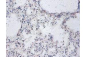 Immunohistochemistry of paraffin-embedded human lung tissue using ABIN7149863 at dilution of 1:100 (SAT1 抗体  (AA 5-171))