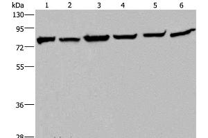 Western Blot analysis of Mouse kidney tissue, HT-29, A549, 293T, MCF-7 and Hela cell using HSPA9 Polyclonal Antibody at dilution of 1:400 (HSPA9 抗体)