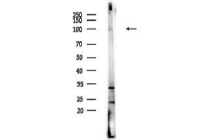 anti-Tubulin, gamma Complex Associated Protein 2 (TUBGCP2) (Internal Region) antibody