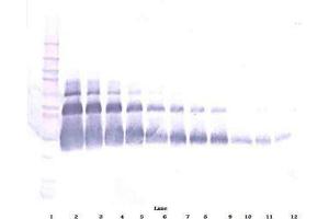 Image no. 1 for anti-Vascular Endothelial Growth Factor A (VEGFA) antibody (Biotin) (ABIN465276) (VEGFA 抗体  (Biotin))