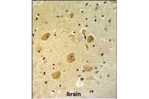 Immunohistochemistry (Paraffin-embedded Sections) (IHC (p)) image for anti-Poly (ADP-Ribose) Polymerase Family, Member 16 (PARP16) (AA 215-244), (C-Term) antibody (ABIN652189)