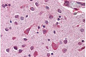 Human Brain, Cortex (formalin-fixed, paraffin-embedded) stained with MCL1 antibody ABIN214512 at 2 ug/ml followed by biotinylated goat anti-rabbit IgG secondary antibody ABIN481713, alkaline phosphatase-streptavidin and chromogen. (MCL-1 抗体  (C-Term))