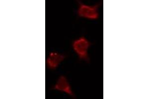 ABIN6274036 staining Hela by IF/ICC. (PIK3R2 抗体  (C-Term))