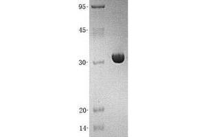Western Blotting (WB) image for Phenazine Biosynthesis-Like Protein Domain Containing 1 (PBLD1) (Transcript Variant 1) protein (His tag) (ABIN2725568)