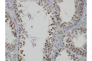Immunoperoxidase of monoclonal antibody to DDX26 on formalin-fixed paraffin-embedded human testis. (INTS6 抗体  (AA 779-887))