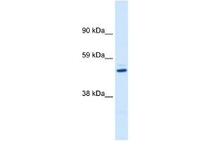 KCNAB1 antibody used at 1 ug/ml to detect target protein. (KCNAB1 抗体  (C-Term))
