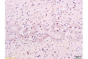 Formalin-fixed and paraffin embedded mouse brain tissue labeled with Anti-CHRNA7 Polyclonal Antibody, Unconjugated (ABIN736911) at 1:200, followed by conjugation to the secondary antibody and DAB staining (CHRNA7 抗体  (AA 441-502))