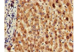 Immunohistochemistry of paraffin-embedded human liver tissue using ABIN7162155 at dilution of 1:100 (OLFML3 抗体  (AA 201-406))