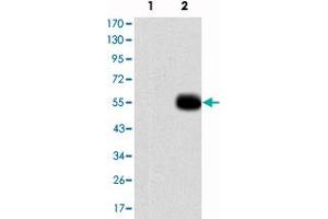 Western blot analysis using MMP9 monoclonal antibody, clone 5C3  against HEK293 (1), MMP7-hIgGFc transfected HEK293 (2) cell lysate and MMP9-hIgGFc transfected HEK293 (3) cell lysate. (MMP 9 抗体)