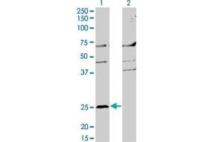 Western Blot analysis of MS4A2 expression in transfected 293T cell line by MS4A2 monoclonal antibody (M02), clone 3B1. (MS4A2 抗体  (AA 1-59))