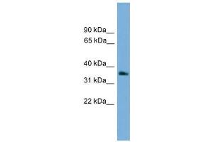 GNB4 antibody used at 0. (GNB4 抗体  (Middle Region))